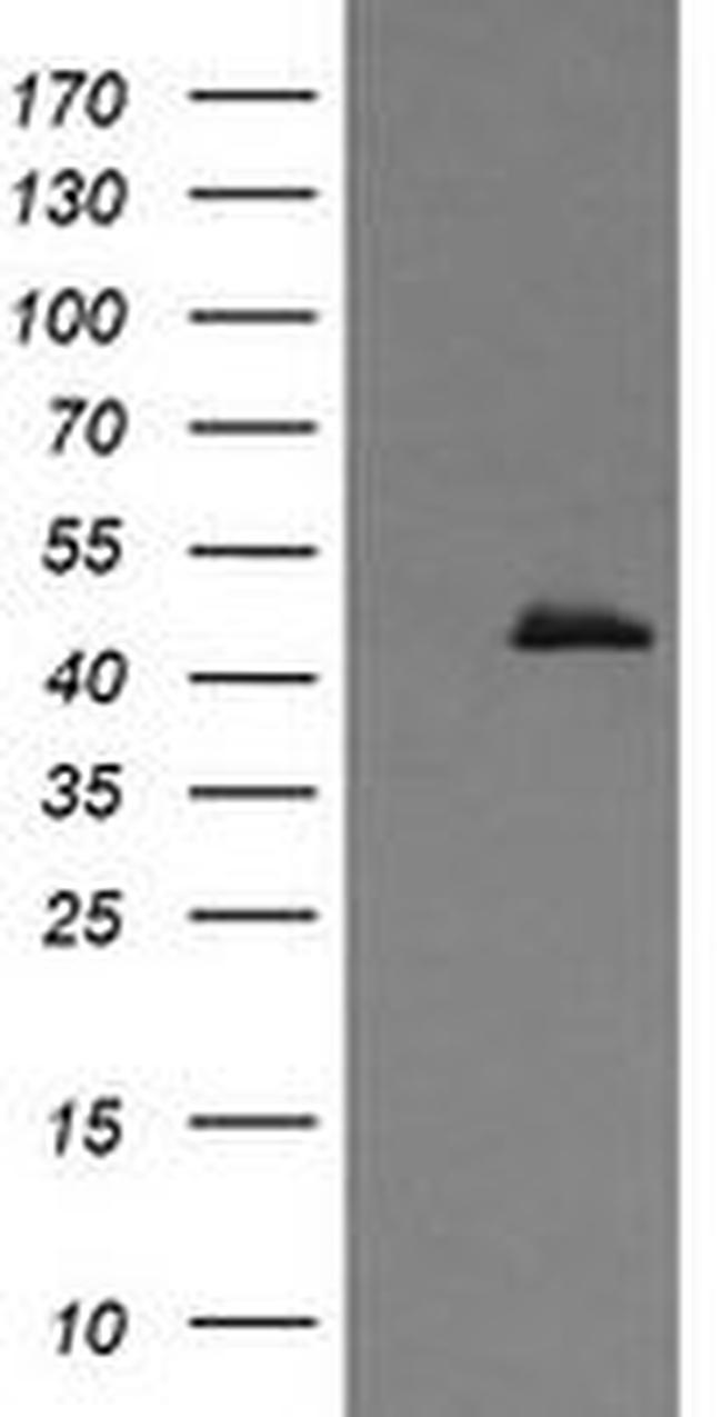 CALR3 Antibody in Western Blot (WB)