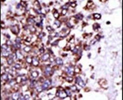 CaMKI Antibody in Immunohistochemistry (IHC)