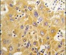 CAMK1D Antibody in Immunohistochemistry (IHC)