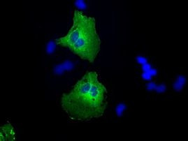 CAMK1D Antibody in Immunocytochemistry (ICC/IF)