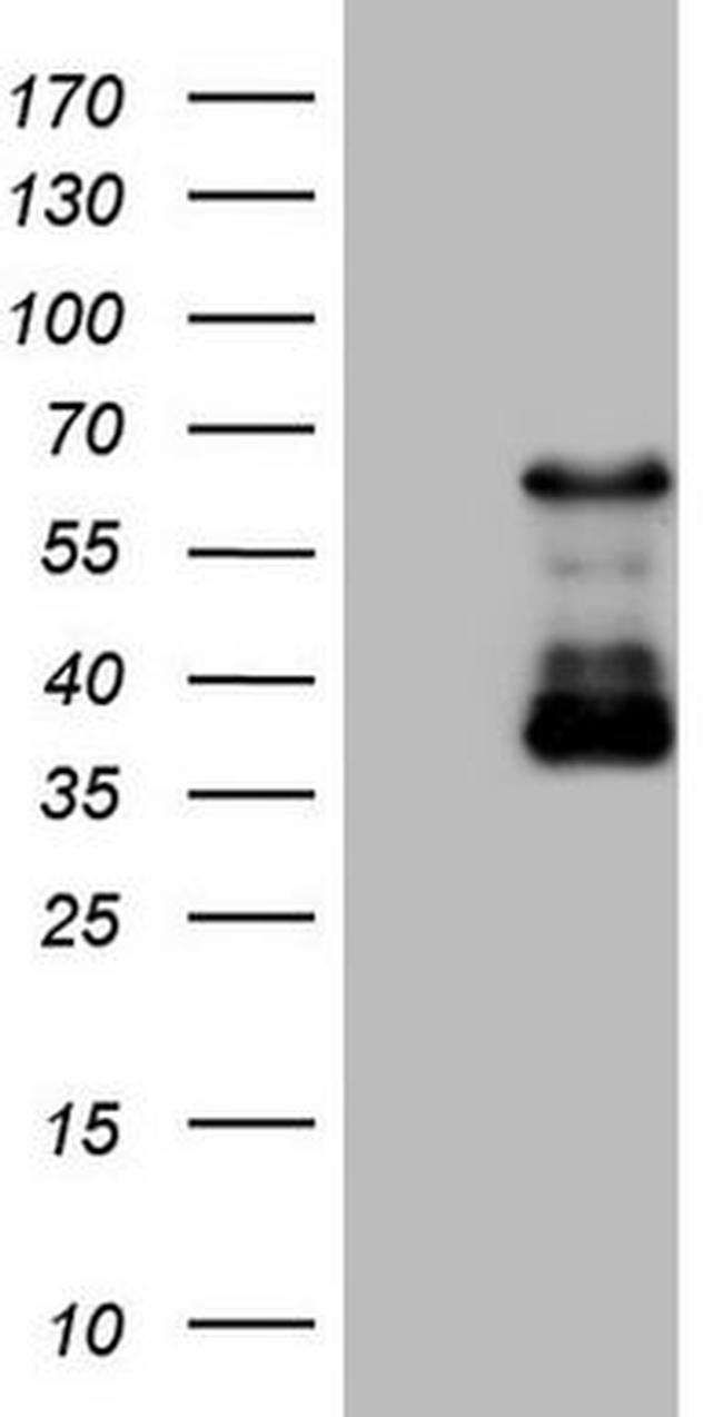 CAMK2B Antibody in Western Blot (WB)