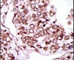 CaMKII gamma Antibody in Immunohistochemistry (IHC)