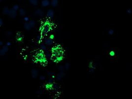 CAMLG Antibody in Immunocytochemistry (ICC/IF)