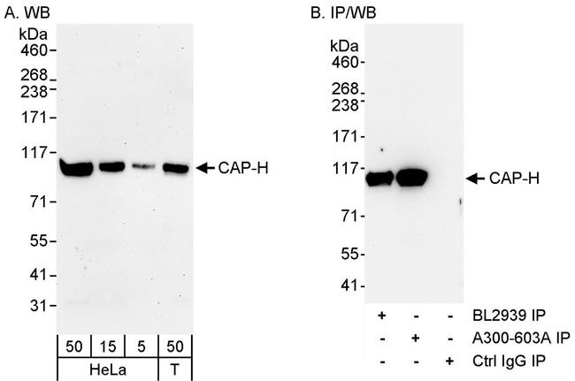 CAP-H Antibody in Western Blot (WB)