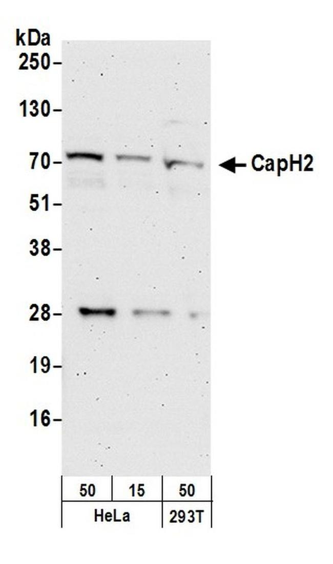 CAP-H2 Antibody in Western Blot (WB)