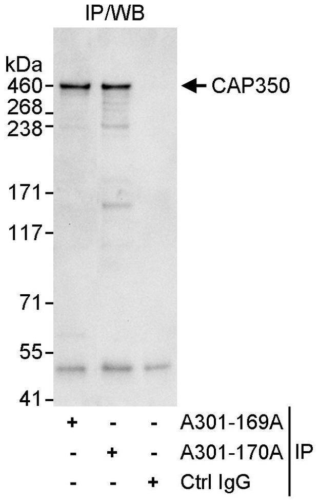 CAP350 Antibody in Immunoprecipitation (IP)