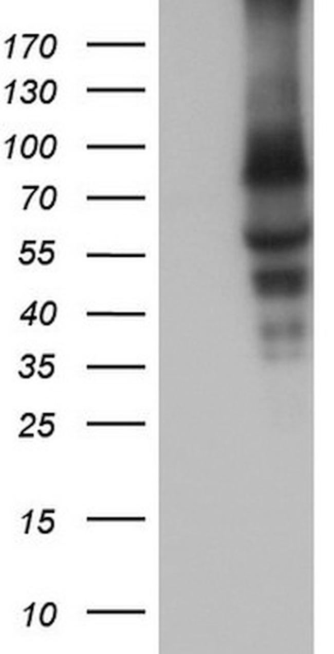 CAPN5 Antibody in Western Blot (WB)