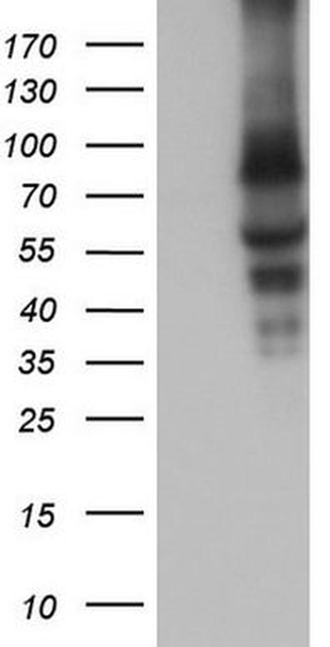 CAPN5 Antibody in Western Blot (WB)
