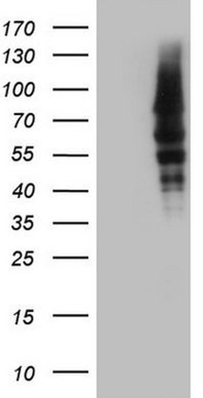 CAPN5 Antibody in Western Blot (WB)