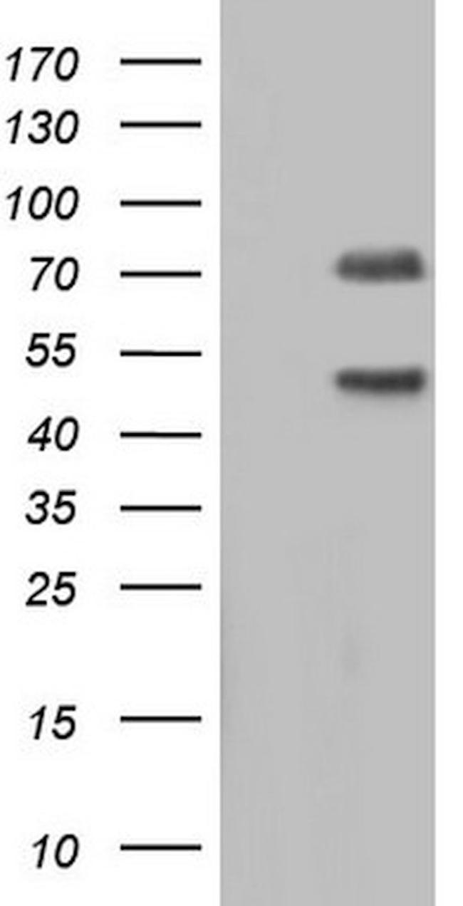 CAPN5 Antibody in Western Blot (WB)