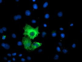 CAPN9 Antibody in Immunocytochemistry (ICC/IF)