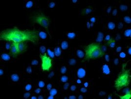 CAPN9 Antibody in Immunocytochemistry (ICC/IF)