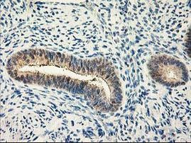 CAPN9 Antibody in Immunohistochemistry (Paraffin) (IHC (P))