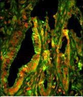 CAPZA1 Antibody in Immunohistochemistry (Paraffin) (IHC (P))