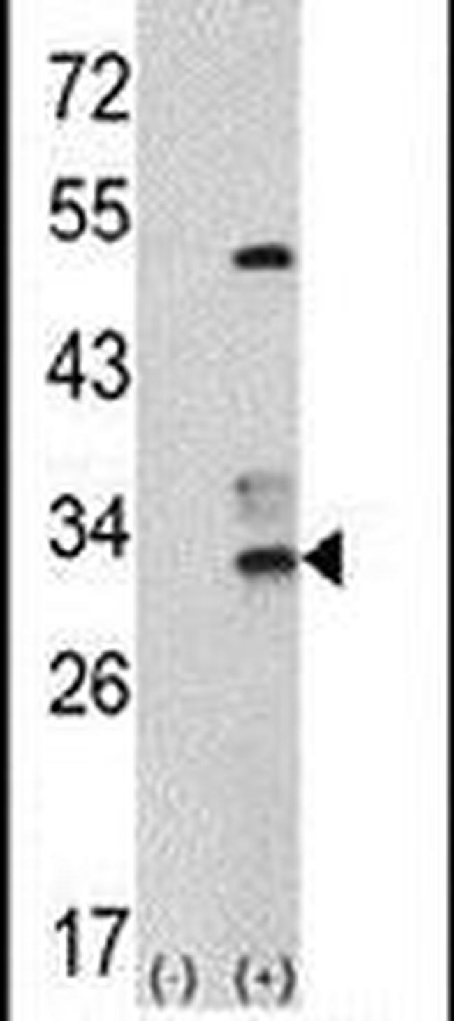 CAPZB Antibody in Western Blot (WB)
