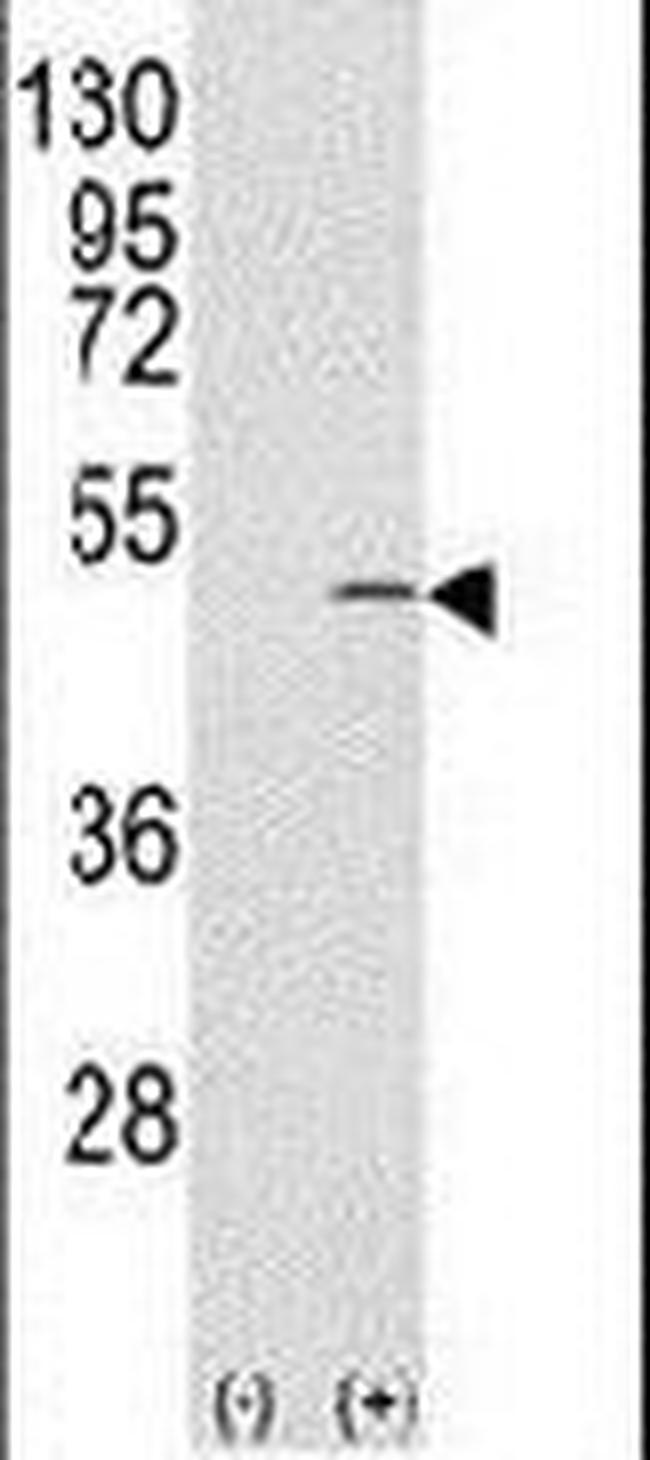 CAPZB Antibody in Western Blot (WB)