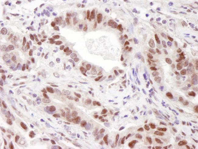 CARM1 Antibody in Immunohistochemistry (IHC)