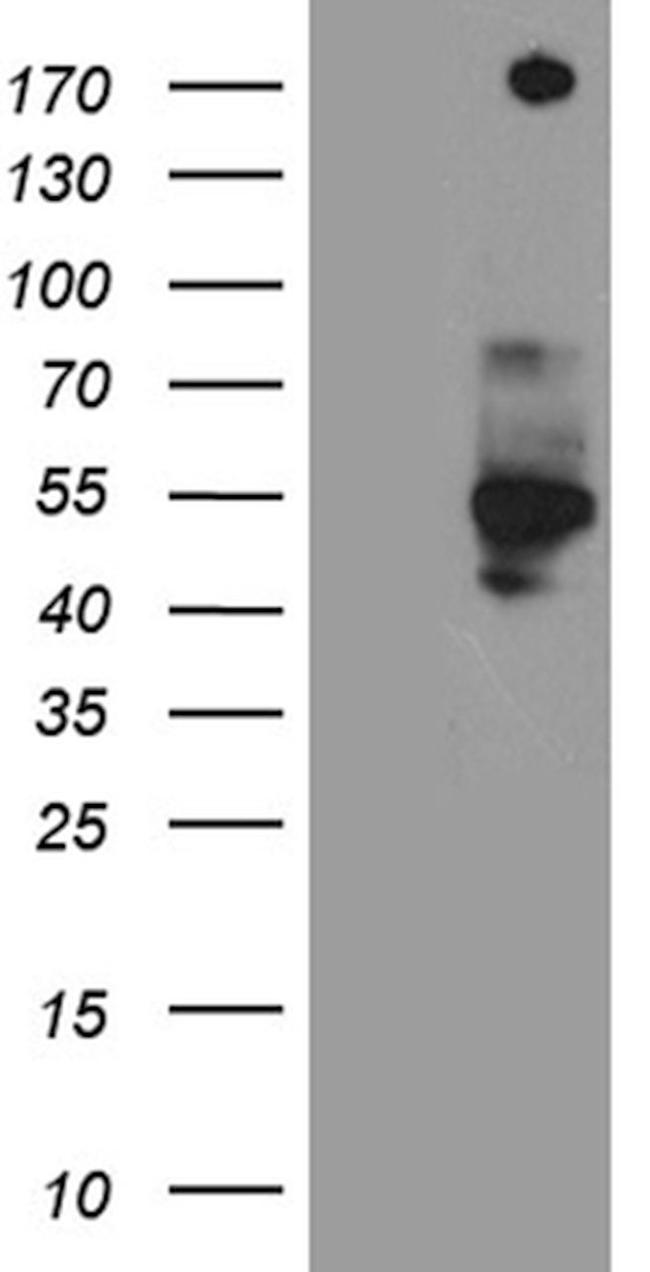 Cas9 Antibody in Western Blot (WB)