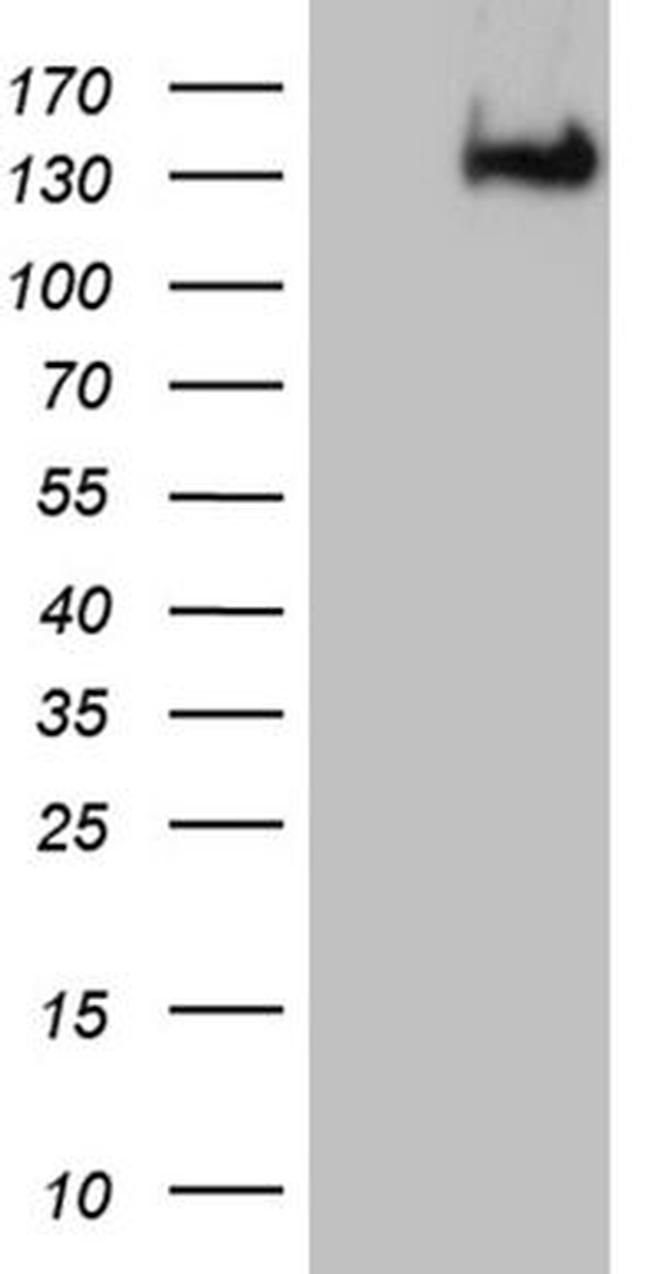 Cas9 Antibody in Western Blot (WB)