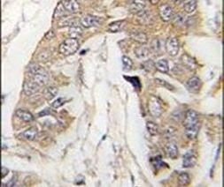 CASC3 Antibody in Immunohistochemistry (IHC)