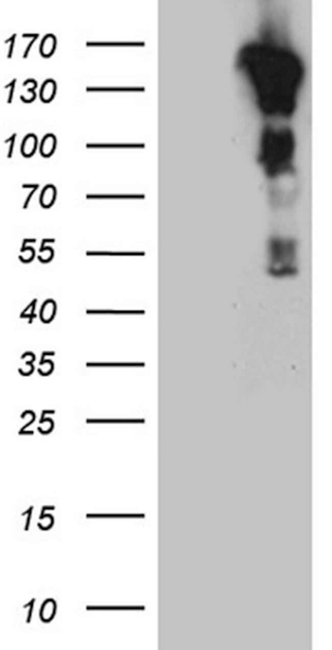 CASKIN2 Antibody in Western Blot (WB)