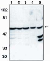 Caspase 10 Antibody in Western Blot (WB)