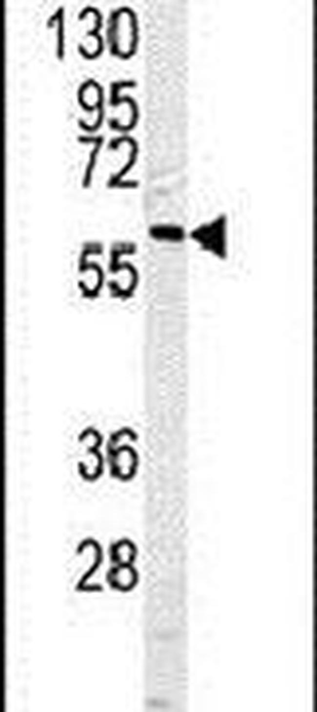 Caspase 10 Antibody in Western Blot (WB)