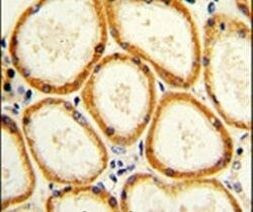 Caspase 2 Antibody in Immunohistochemistry (IHC)