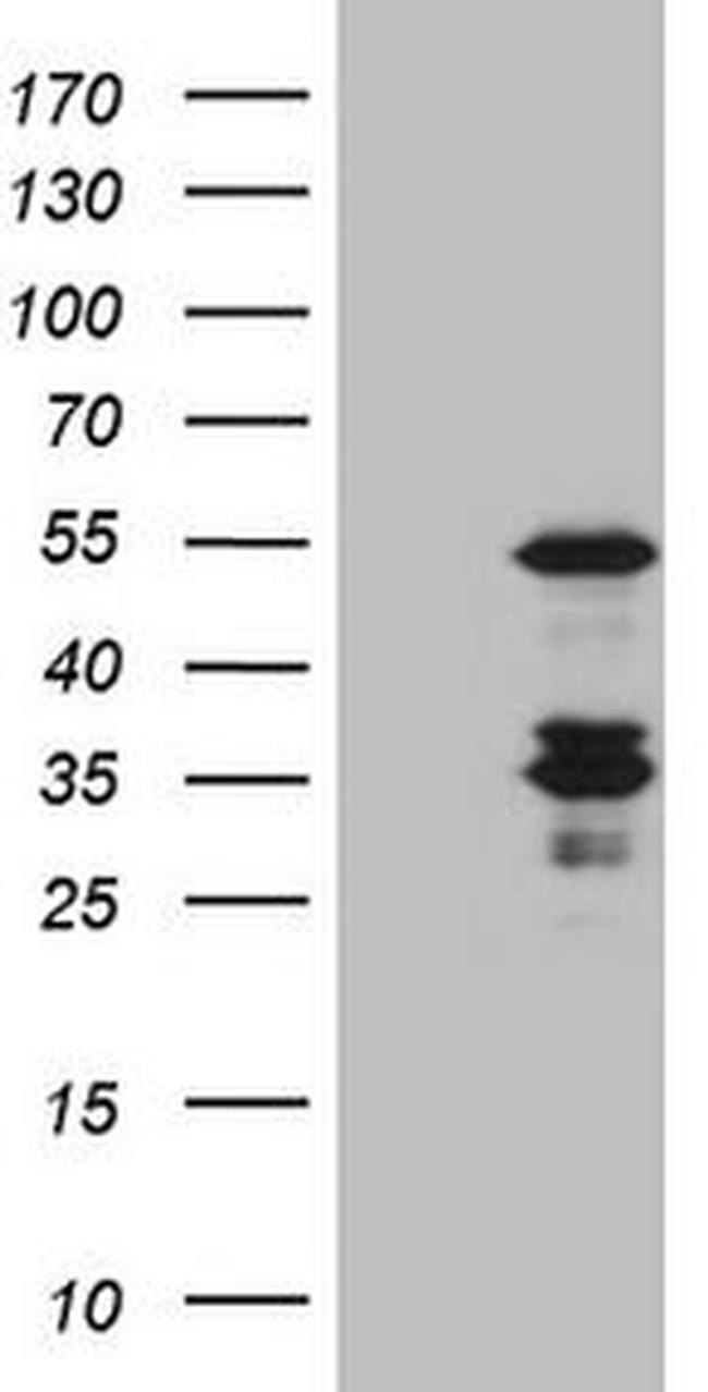 CASP4 Antibody in Western Blot (WB)