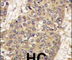 Caspase 6 Antibody in Immunohistochemistry (IHC)