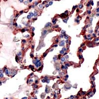 Caveolin 1 Antibody in Immunohistochemistry (IHC)