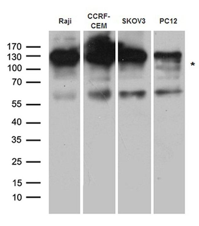 CBL Antibody in Western Blot (WB)