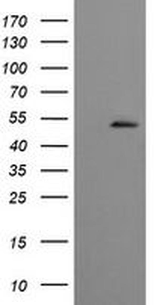 CBLC Antibody in Western Blot (WB)