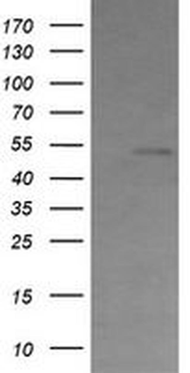 CBLC Antibody in Western Blot (WB)