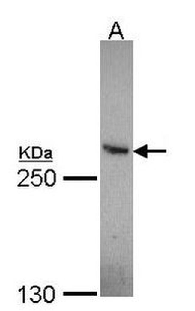 CBP Antibody in Western Blot (WB)