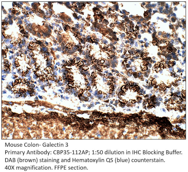 Galectin 3 Antibody in Immunohistochemistry (IHC)