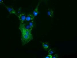 CBWD1 Antibody in Immunocytochemistry (ICC/IF)