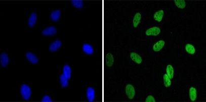 HP1 beta Antibody in Immunocytochemistry (ICC/IF)