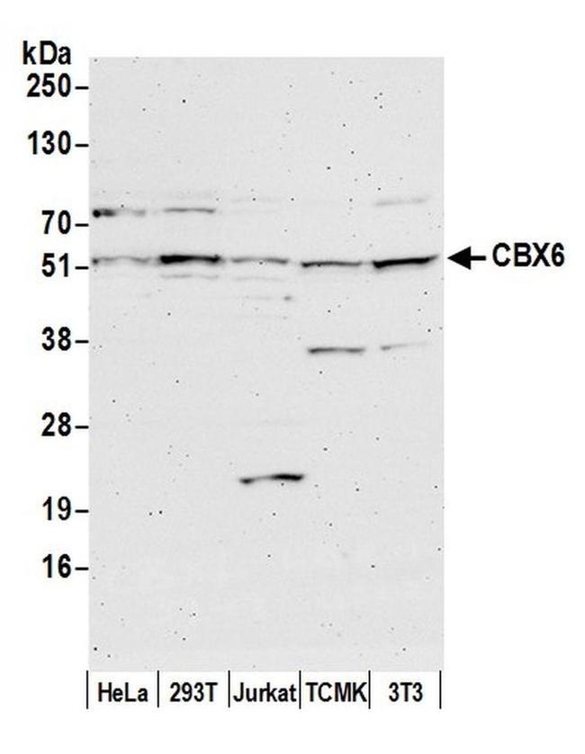 CBX6 Antibody in Western Blot (WB)