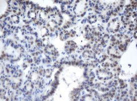 CBX8 Antibody in Immunohistochemistry (Paraffin) (IHC (P))