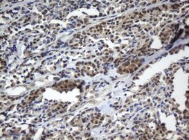 CBX8 Antibody in Immunohistochemistry (Paraffin) (IHC (P))