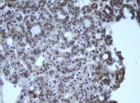 CBX8 Antibody in Immunohistochemistry (Paraffin) (IHC (P))