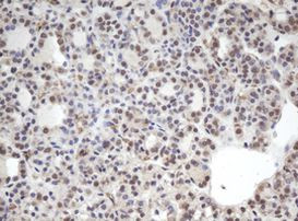 CBX8 Antibody in Immunohistochemistry (Paraffin) (IHC (P))