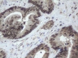 CBX8 Antibody in Immunohistochemistry (Paraffin) (IHC (P))
