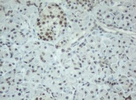 CBX8 Antibody in Immunohistochemistry (Paraffin) (IHC (P))