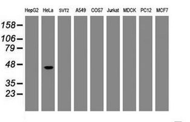 CBX8 Antibody in Western Blot (WB)