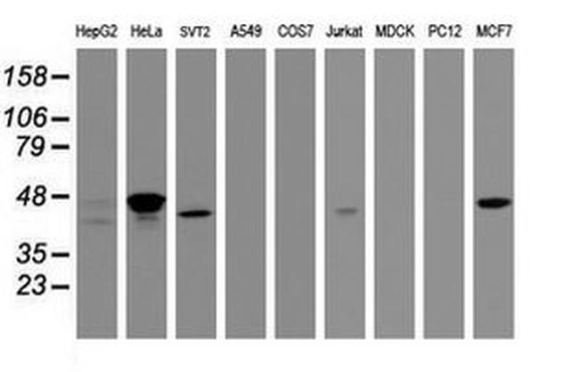CBX8 Antibody in Western Blot (WB)