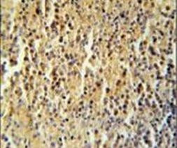 CCDC106 Antibody in Immunohistochemistry (IHC)