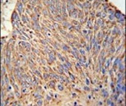 CCDC130 Antibody in Immunohistochemistry (IHC)