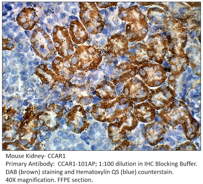 CCAR1 Antibody in Immunohistochemistry (IHC)
